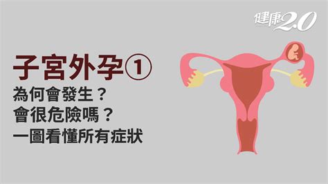 陰蒂穿洞|陰蒂穿環：形成原因、檢查、症狀、治療、預防